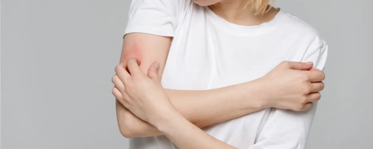 Prurito da acari: sintomi, cause e come riconoscere il problema per proteggere la salute di tutta la famiglia