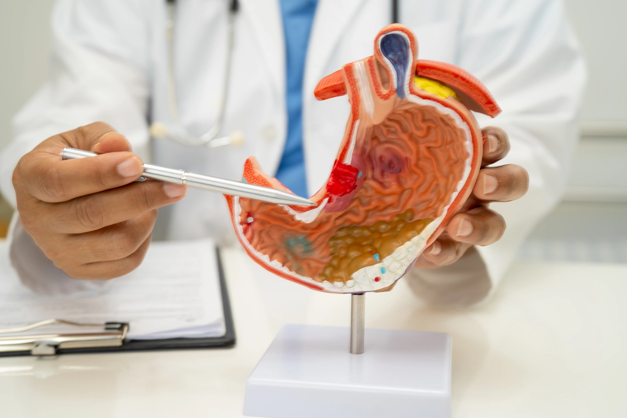 Feci e tumore allo stomaco: ecco quale colore potrebbe essere un campanello d’allarme secondo i medici